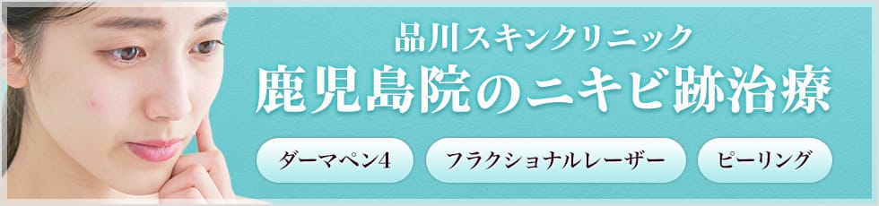品川スキンクリニック 鹿児島院のニキビ跡治療 ダーマペン4 フラクショナルレーザー ピーリング