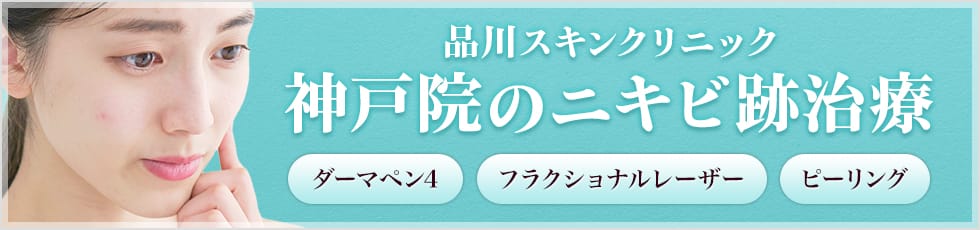 品川スキンクリニック 神戸院のニキビ跡治療 ダーマペン4 フラクショナルレーザー ピーリング