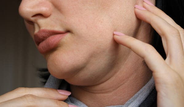 アゴのたるみの原因とは【画像】