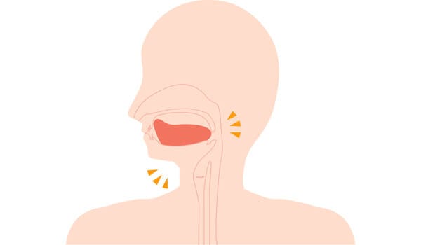 上アゴに舌がついていない【画像】