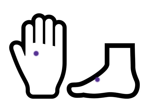 青色母斑【画像】