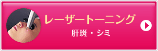 レーザートーニング 肝斑・シミ【画像】