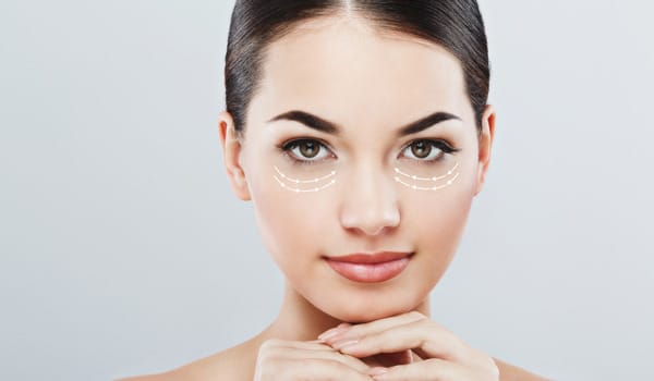 目の下のたるみ治療の術後経過イメージ【画像】