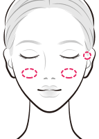 ヒアルロン酸によるホホや耳前部の改善【画像】