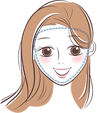 逆三角形タイプ【画像】