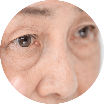 切らないクマ取り