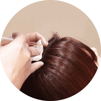 メディカル髪育注射