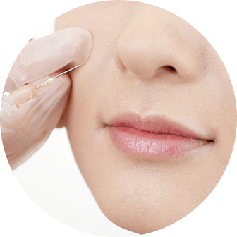 ヒアルロン酸注入