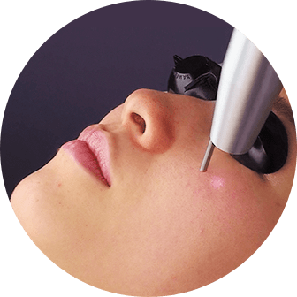 シミ・肝斑トーニング