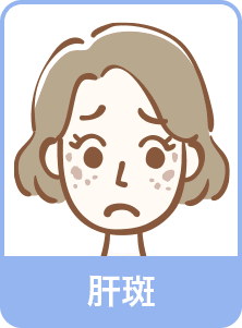肝斑
