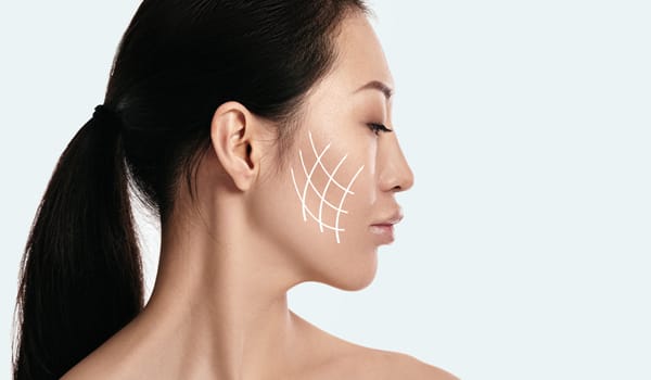 ハイフの効果【画像】