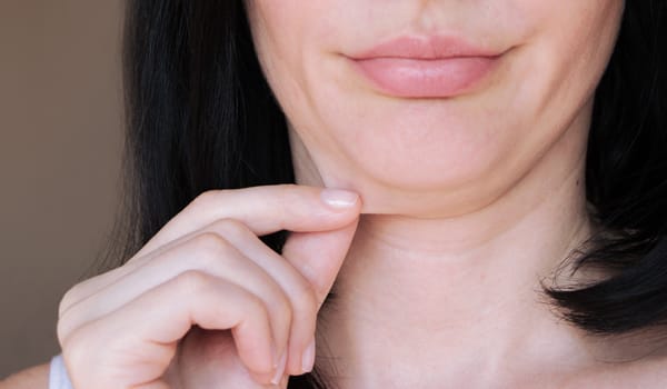 フェイスラインのたるみ【画像】