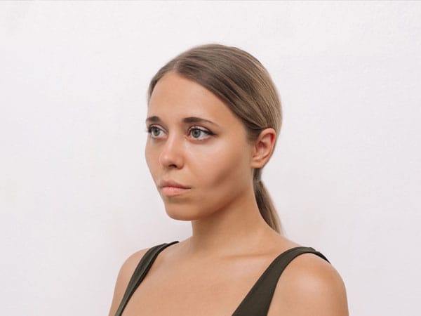 たるみの悪化や頬がこける場合がある【画像】