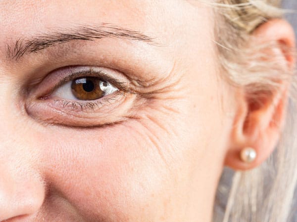 肌のハリやシワが気になってきた人【画像】