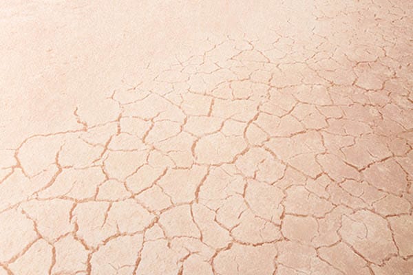 肌の乾燥【画像】