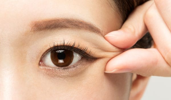 瞼が腫れぼったく見える【画像】