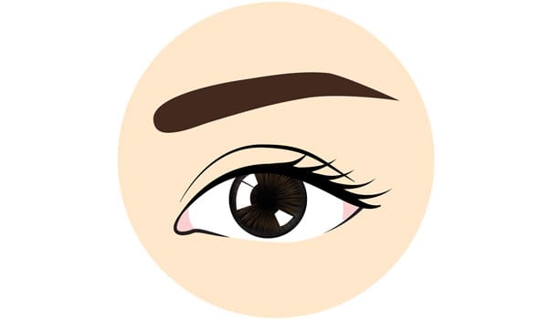 平行型【画像】