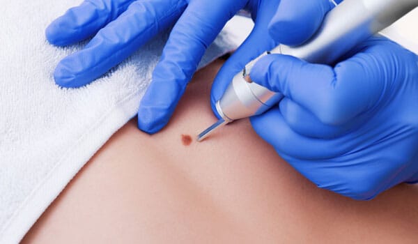 美容皮膚科など医療機関による治療【画像】