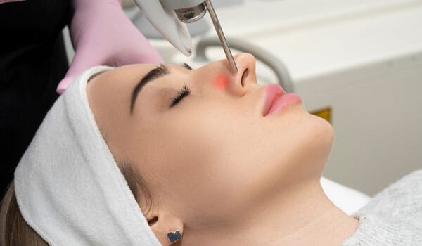 ピコレーザーとは【画像】