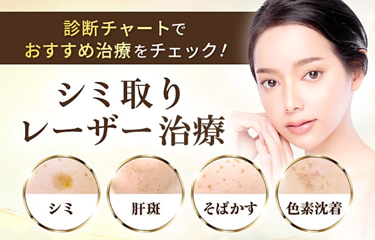 「シミ取りレーザー治療」診断チャートでおすすめ治療をチェック シミ/肝斑/そばかす/色素沈着【画像】