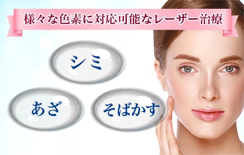 「様々な色素に対応可能なレーザー治療」シミ・あざ・そばかす【画像】