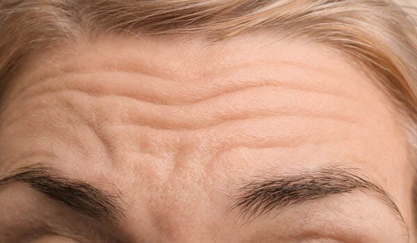 おでこ【画像】