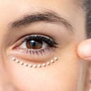 目の下のたるみ特集