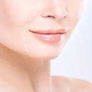 ほうれい線改善特集