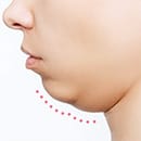 顎(あご)のたるみ改善特集