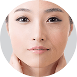 シワの種類 イメージ【画像】