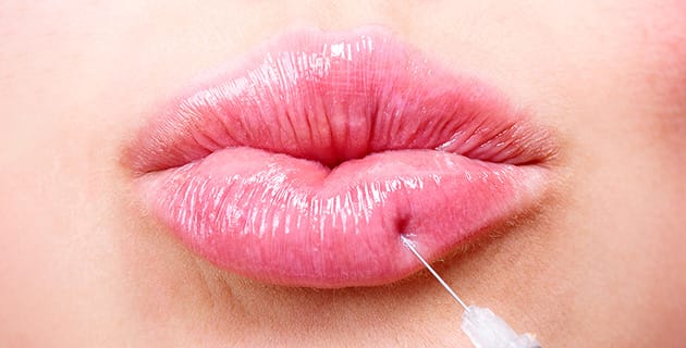 レッド・グロス注射 イメージ【画像】