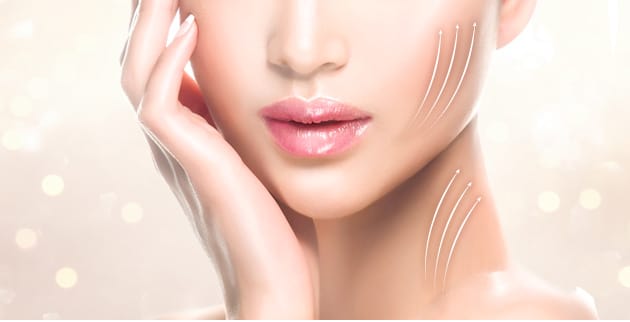 美肌糸リフト イメージ【画像】