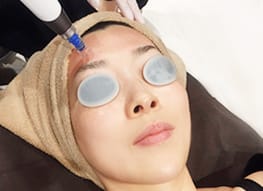 ダーマペンとは【画像】