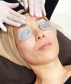 ヴェルベットスキン治療【画像】