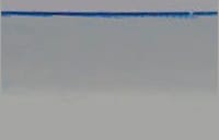 一般マイクロニードル