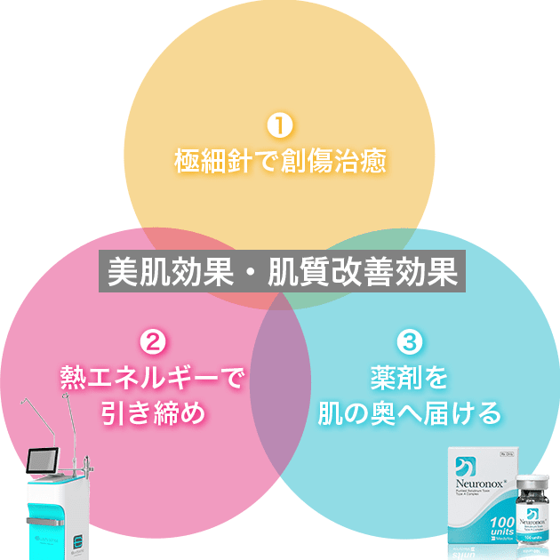 美肌効果・肌質改善効果 ①極細針で創傷治癒 ②熱エネルギーで引き締め ③薬剤を肌の奥へ届ける【画像】
