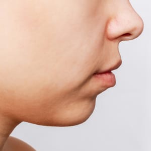 弾力改善【画像】