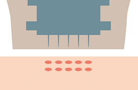 止血作用・引き締め・コラーゲン生成を促進【画像】