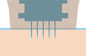 薬剤が針と一緒にムラなく均一に浸透【画像】