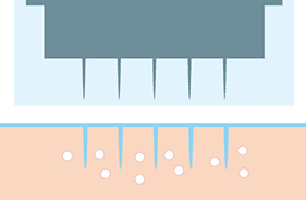 塗布した薬剤が穴に浸透していく【画像】