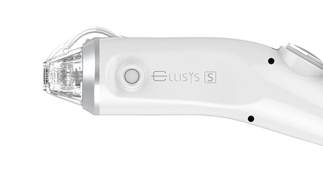 ステップモーター機能が ダウンタイムを短くする【画像】