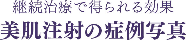 継続治療で得られる効果 美肌注射の症例写真