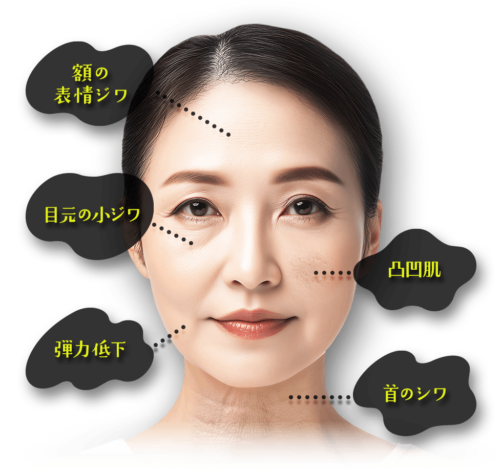 額の表情ジワ・目元の小ジワ・弾力低下・凸凹肌・首のシワ