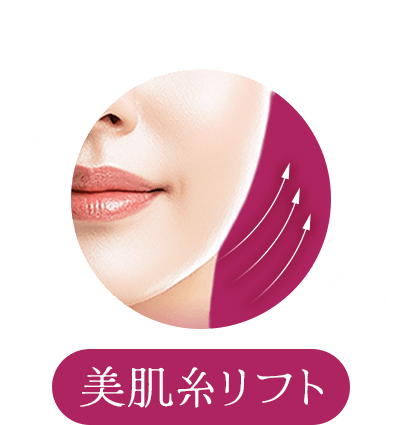 美肌糸リフト
