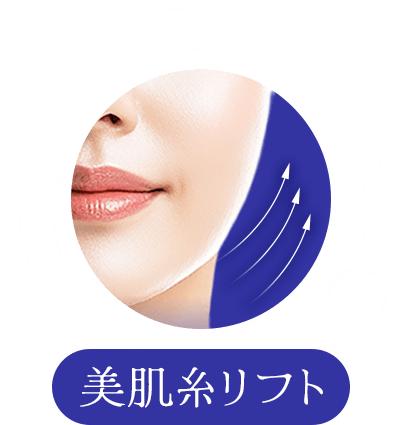 美肌糸リフト