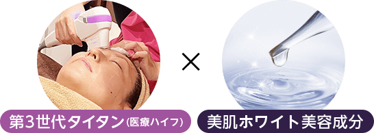 第3世代タイタン（医療ハイフ）×美肌ホワイト美容成分【画像】