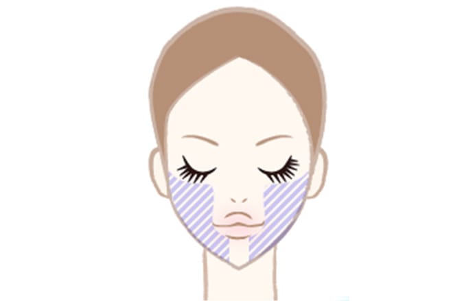 【光沢美白】処置部位：ホホ・ホホ下