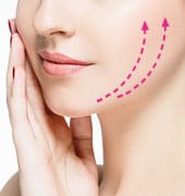 美肌糸リフト【画像】