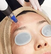 ダーマペン【画像】