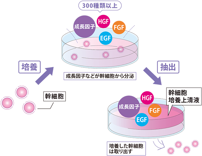 点滴に使用する幹細胞培養上清液イメージ【画像】